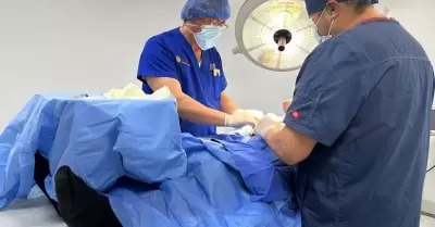 Vasectom�a sin bistur�