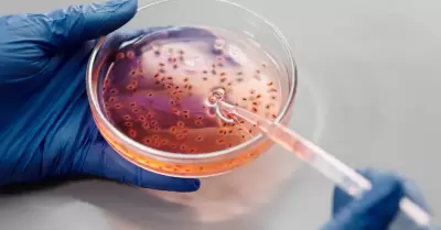 Han confirmado tres casos de infeccin por la bacteria Burkholderia pseudomallei