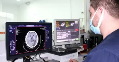 Concientiza Secretar�a de Salud sobre enfermedad que afecta el sistema nervioso 