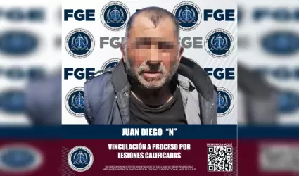 Sujeto que presuntamente lesion con arma de fuego a una persona