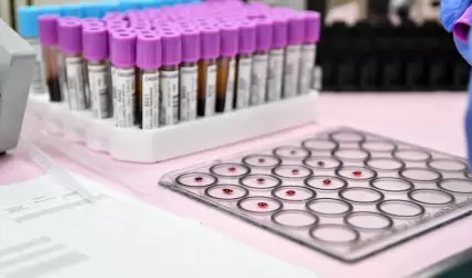 Promueve ISSSTECALI autocuidado para la prevenci�n de hepatitis