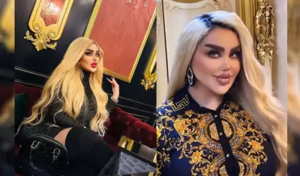 Se hizo m�s de 40 cirug�as para lucir como "Barbie"