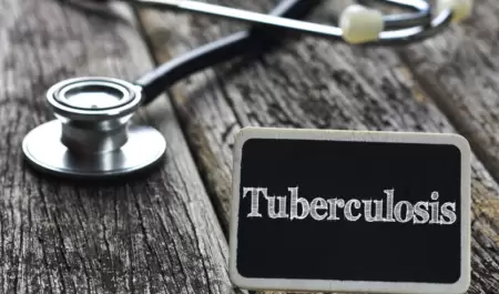 Tuberculosis