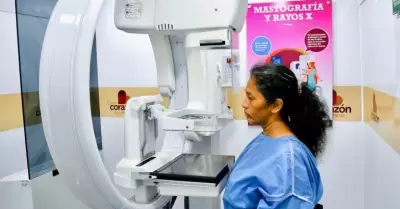 Mega jornada de mastograf�as gratuitas