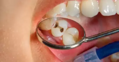 Problemas dentales
