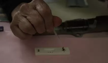 Cuentan Centros de Salud de Ensenada con prueba de ant�geno prost�tico