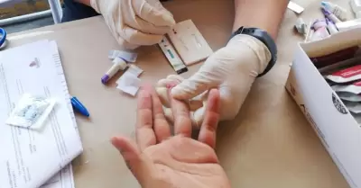 Prueba r�pida de VIH-Sida