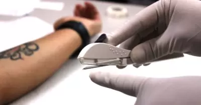 Se capacita personal en la aplicacin del implante subdrmico doble varilla