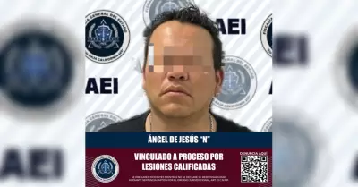 Vinculado a proceso penal acusado de lesiones