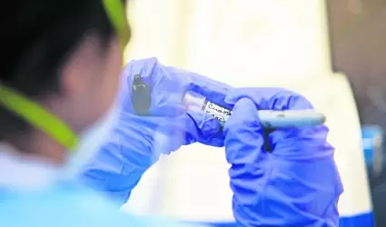 influenza aviar