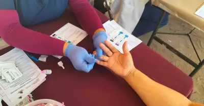 Pruebas rpidas de VIH-SIDA y hepatitis "C"