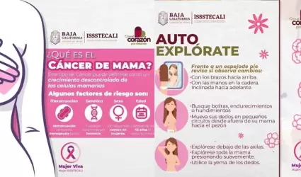 Issstecali invita a mujeres y hombres mayores de 40 aos a realizarse mamografa