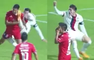 VIDEO Patean brutalmente en la cara a jugador en la Liga de Expansin