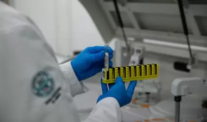Recomiendan vigilar s�ntomas respiratorios ante condiciones clim�ticas
