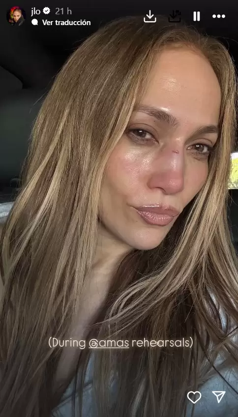 Jennifer Lopez se lastim el rostro en los ensayos para los premios AMA's
