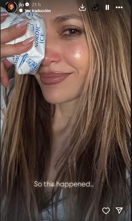 Jennifer Lopez se lastim el rostro en los ensayos para los premios AMA's