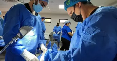 Vasectomas sin bistur gratuitas