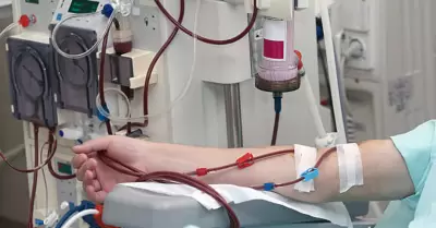 Hemodiálisis
