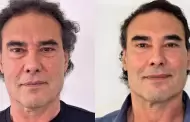 Eduardo Y��ez se somete a tratamiento de rejuvenecimiento facial