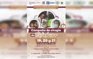 Invita el Sistema DIF Baja California a la campaa anual de ciruga de estrabismo