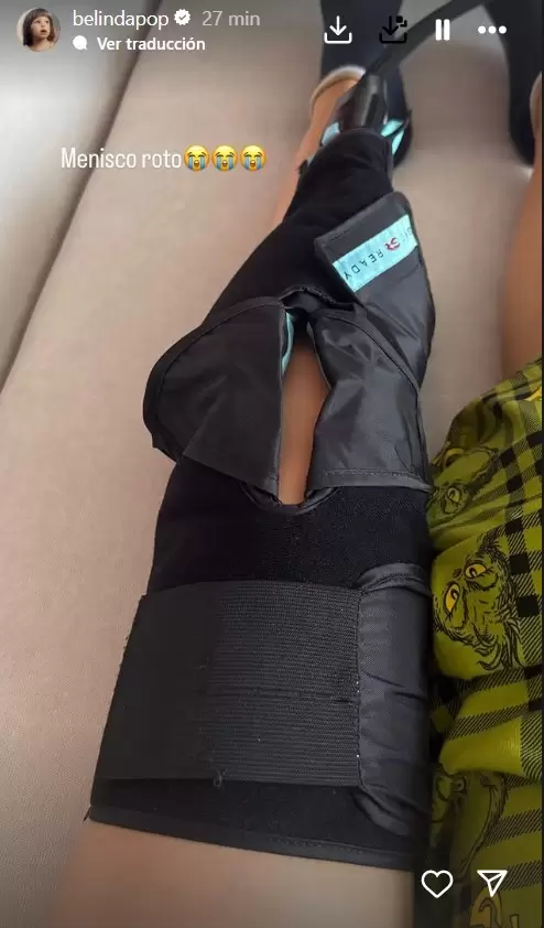 Belinda sufri una fuerte lesin en la pierna