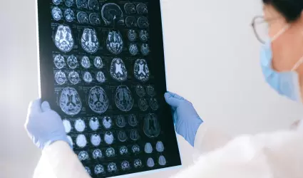 Sensibilizacin sobre el Alzheimer