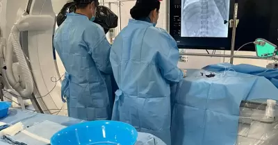 Cateterismo card�aco