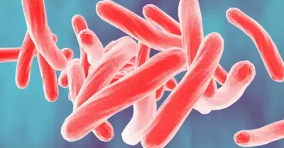 Tuberculosis