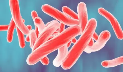 Tuberculosis