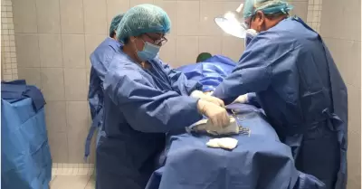 Vasectoma sin bistur