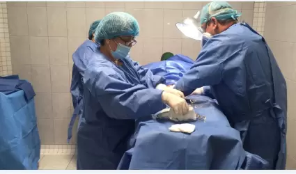 Vasectoma sin bistur