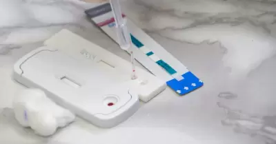 Prevencin, atencin y tratamiento integral del VIH