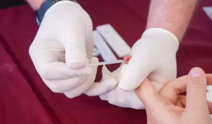 Lucha contra el SIDA