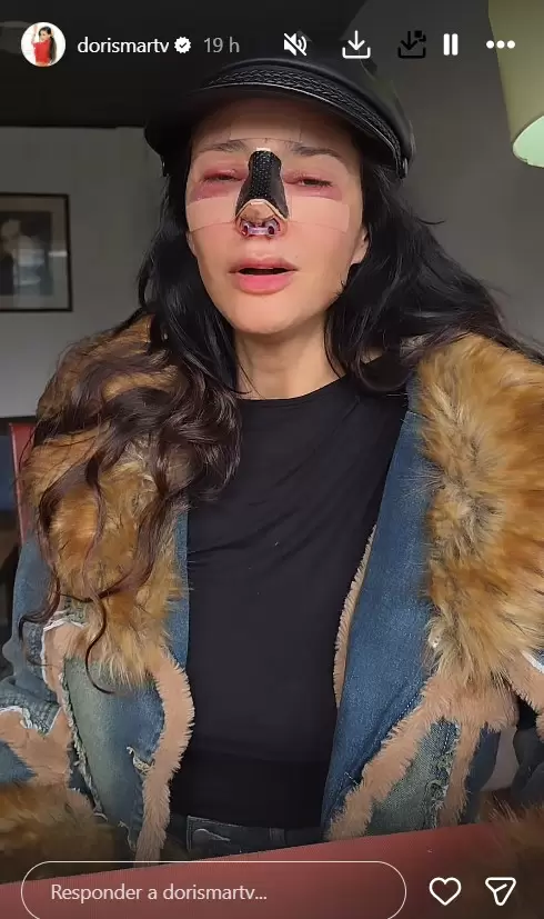 Dorismar reaparece con el rostro desfigurado tras cirugías estéticas fallidas