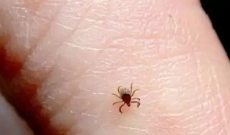 Rickettsiosis
