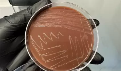 Infecciones de transmisi�n sexual contin�an a la baja