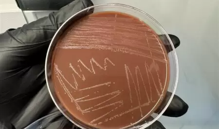 Infecciones de transmisi�n sexual contin�an a la baja