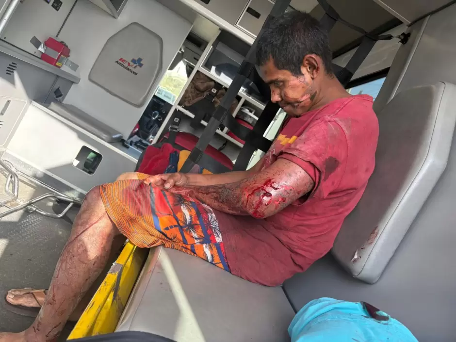 Intento de homicidio a migrante