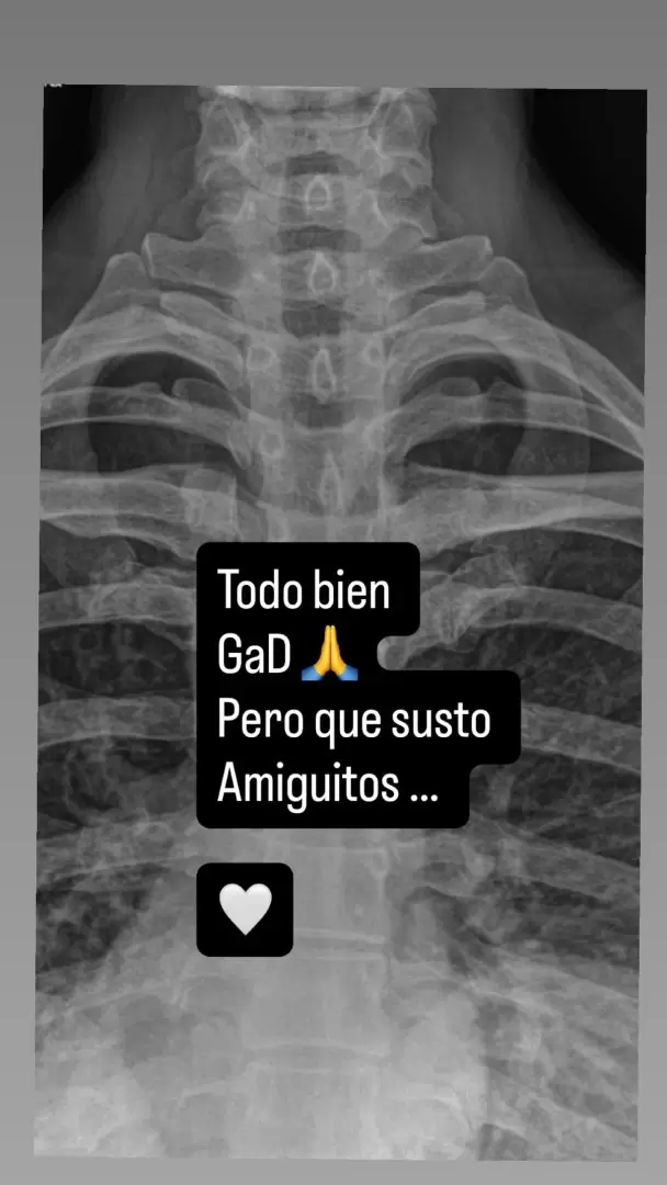 Anah� sufre terrible accidente en el gimnasio