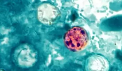 ciclosporiasis