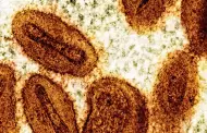 El condado de San Diego confirma el primer caso de Mpox del clado I