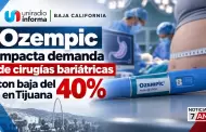 Ozempic impacta demanda de cirug�as bari�tricas con baja del 40% en Tijuana